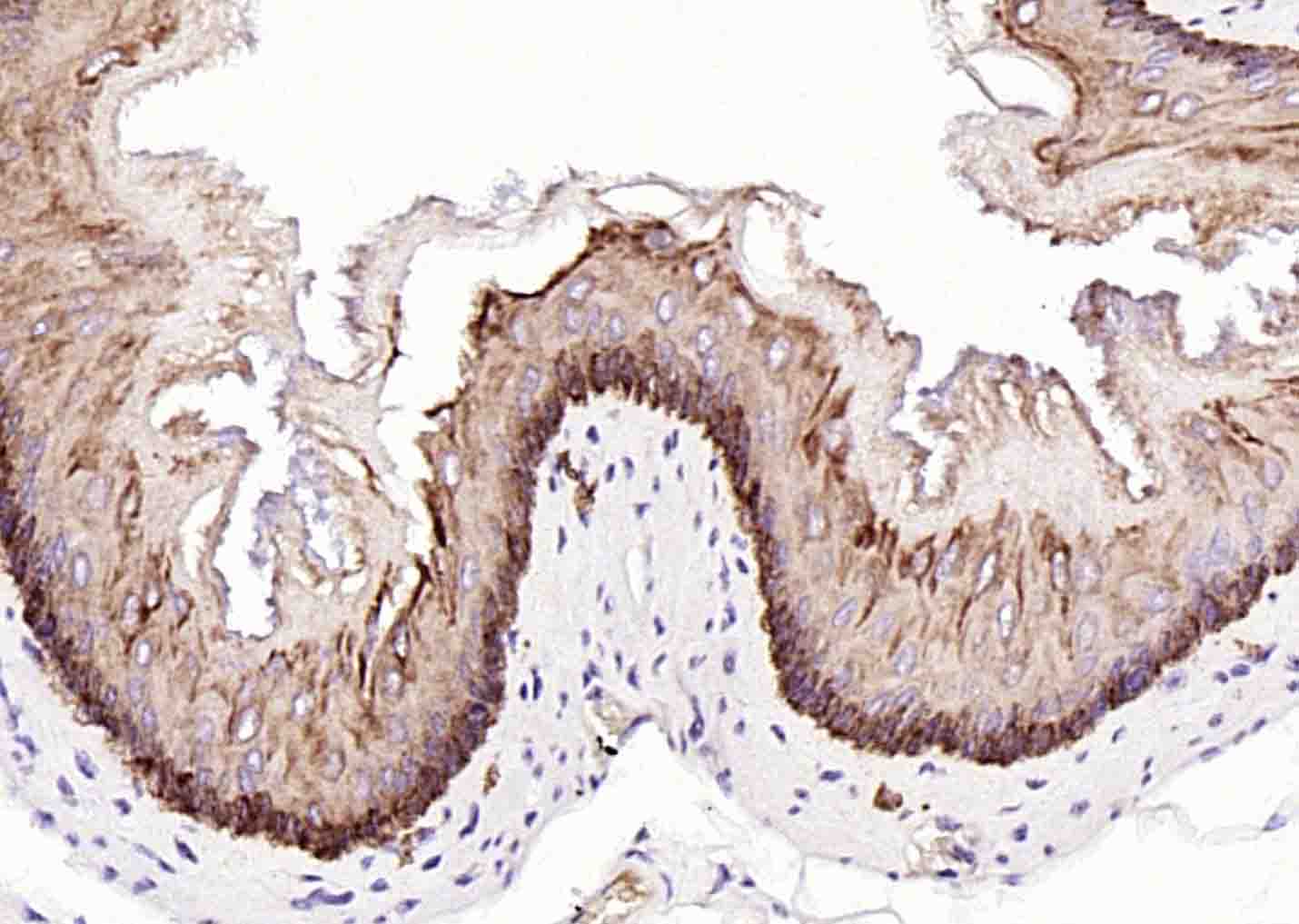 细胞角蛋白14t单克隆抗体-bsm-34152M