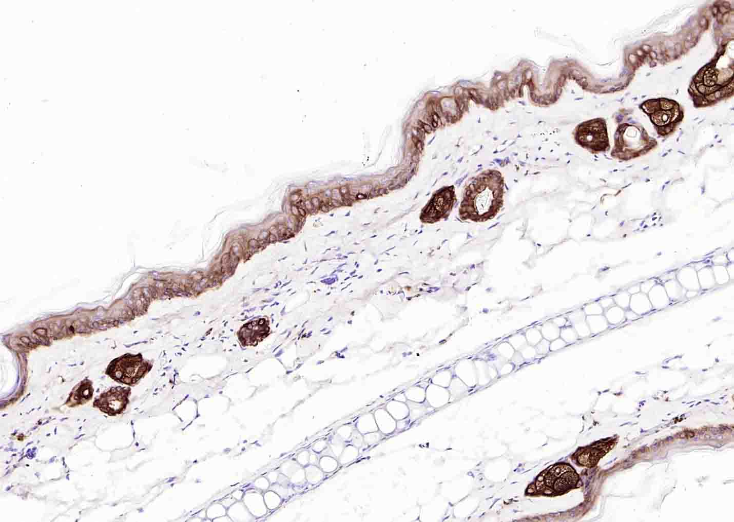 细胞角蛋白14t单克隆抗体-bsm-34152M