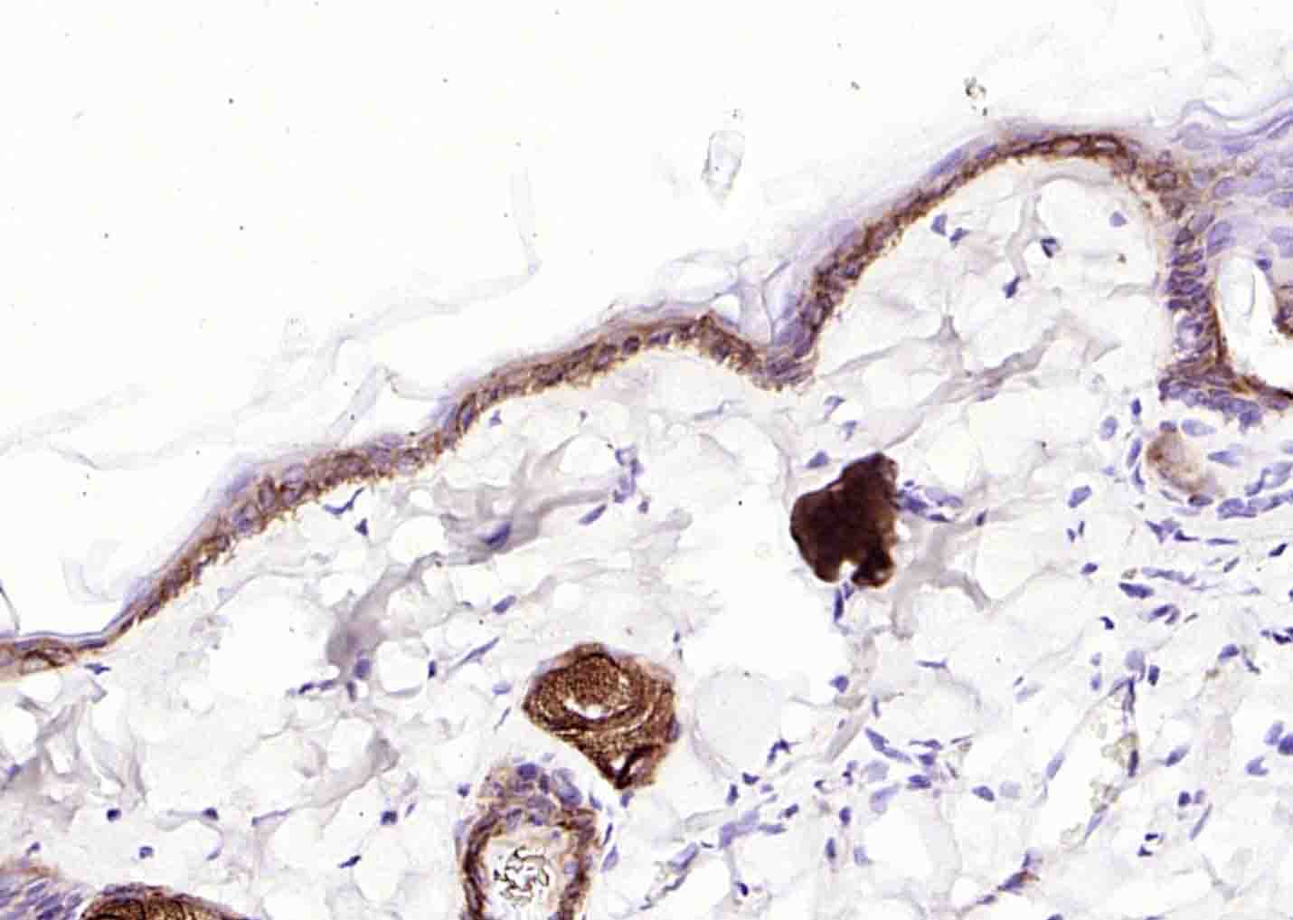 细胞角蛋白14t单克隆抗体-bsm-34152M