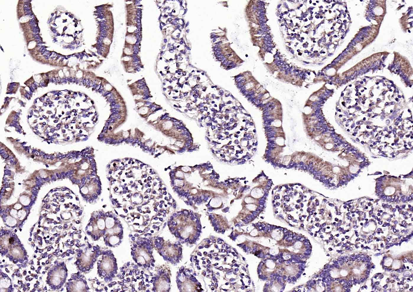 血清淀粉样蛋白A抗体-bs-19359R