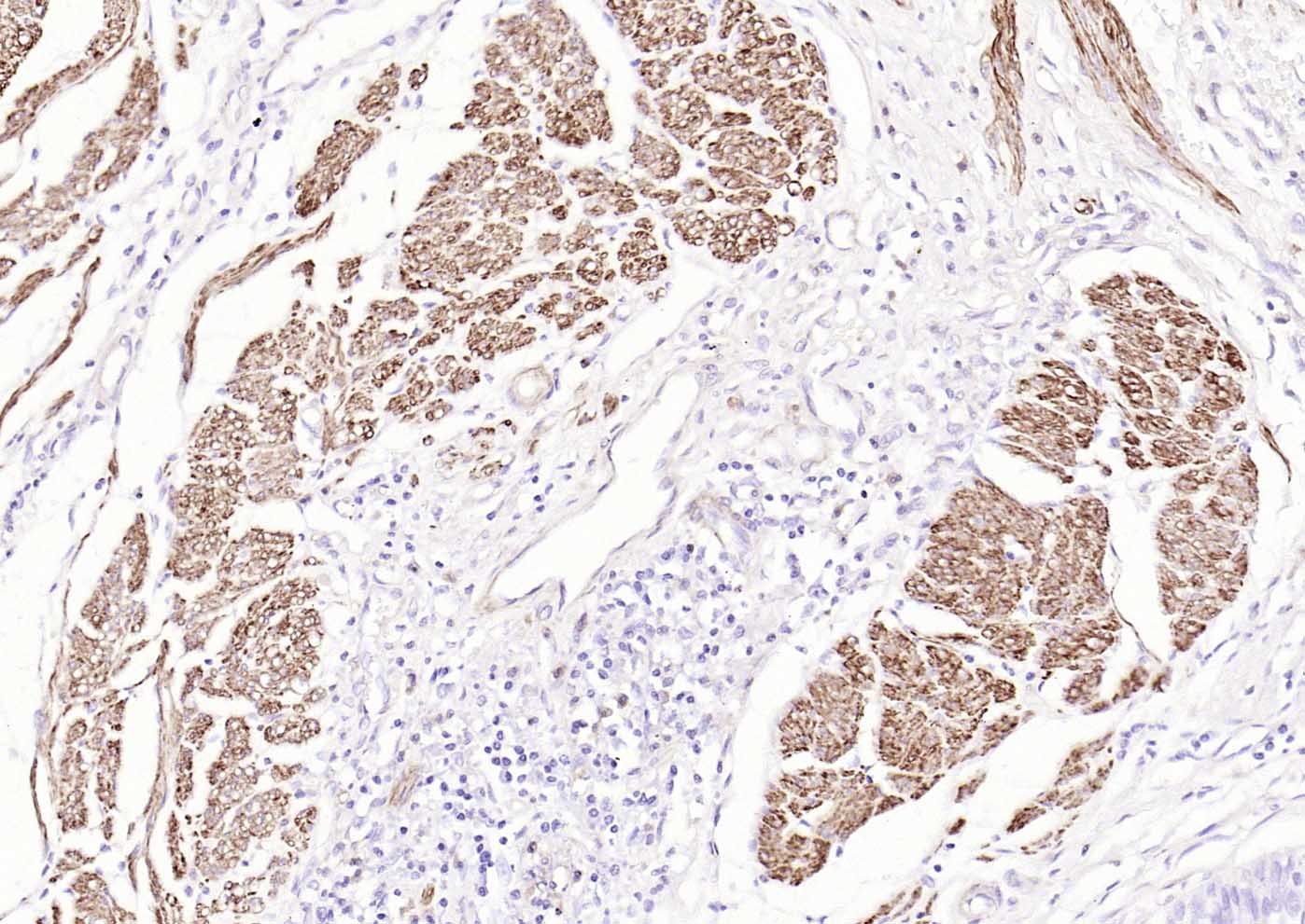 泛肌动蛋白重组兔单抗