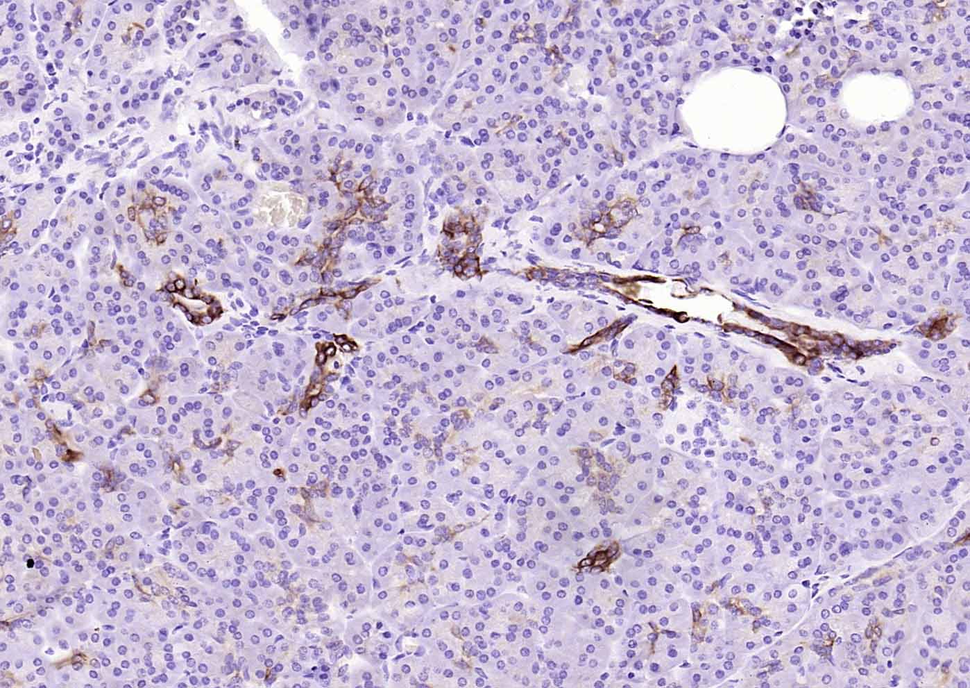 磷酸化糖原合酶激酶-3β重组兔单抗