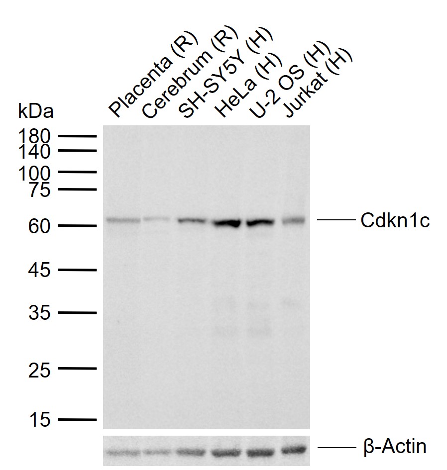 Cdkn1c Rabbit pAb (一抗) | Bioss