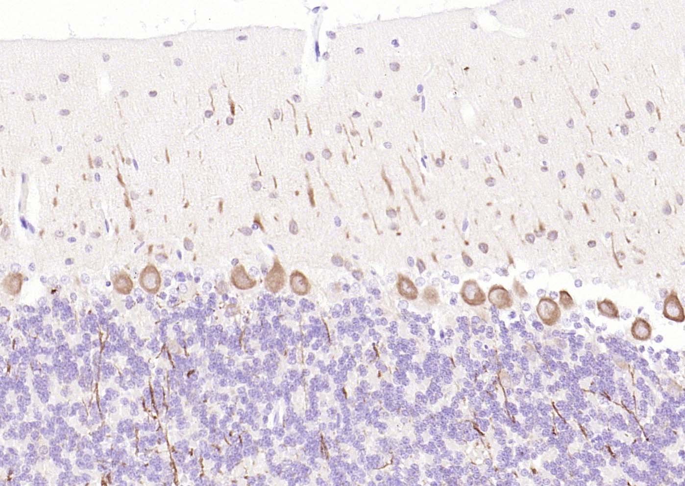 自噬微管相关蛋白轻链3单克隆抗体-bsm-33309M
