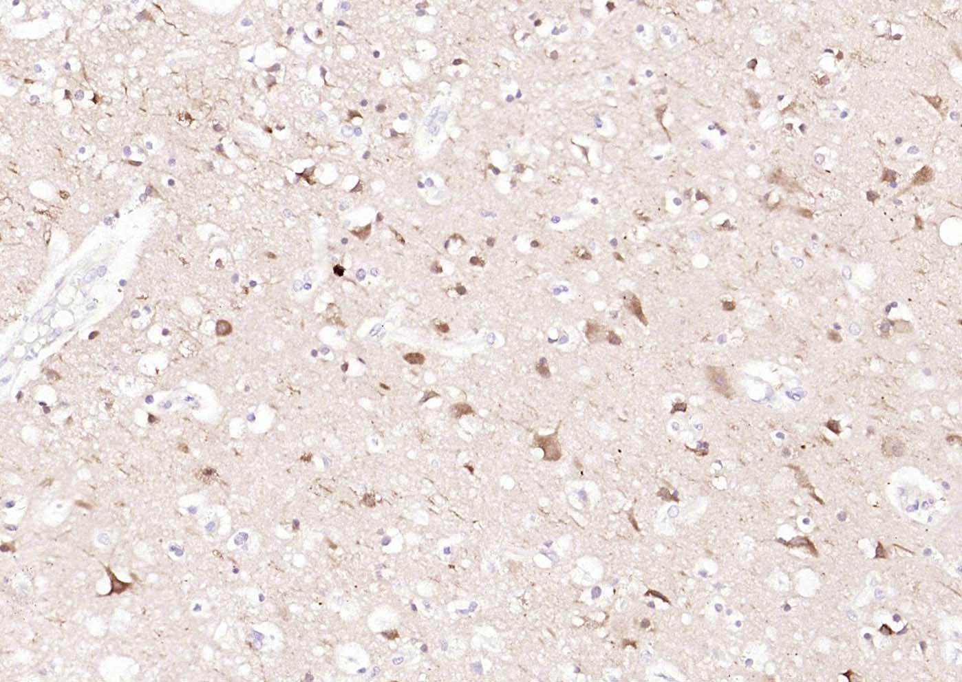 自噬微管相关蛋白轻链3单克隆抗体-bsm-33309M