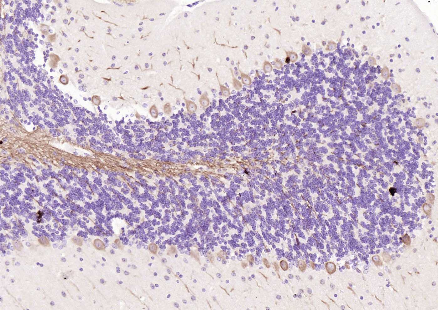 自噬微管相关蛋白轻链3单克隆抗体-bsm-33309M