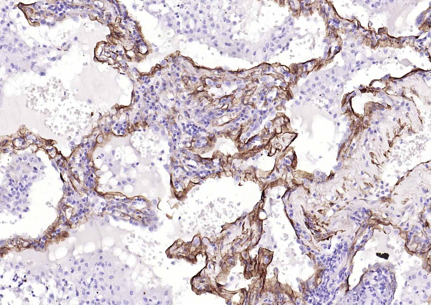 Caveolin-1 Recombinant Rabbit mAb (一抗) | Bioss