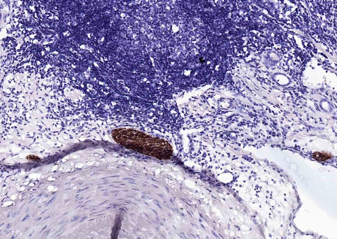 神经细胞粘附分子1重组鼠单抗-bsm-54786M