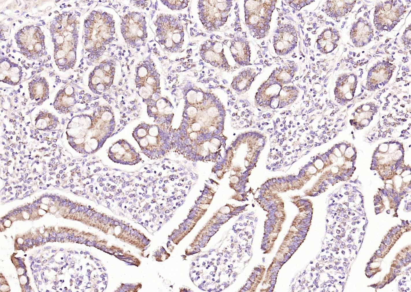 血清淀粉样蛋白A抗体-bs-19359R