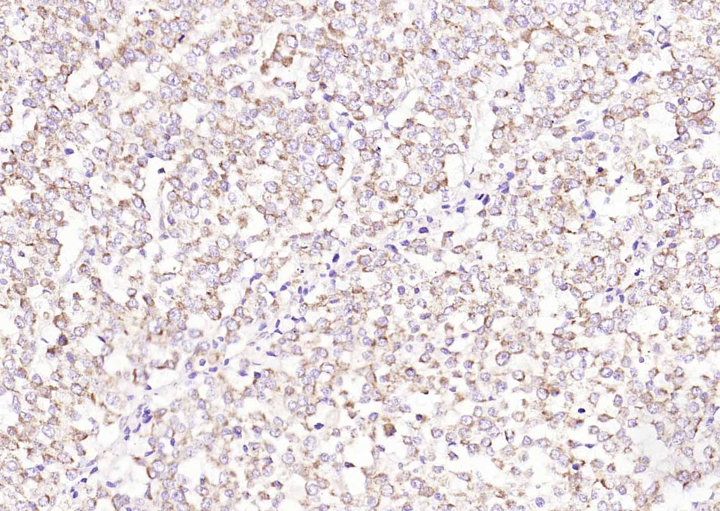 血清淀粉样蛋白A抗体-bs-19359R