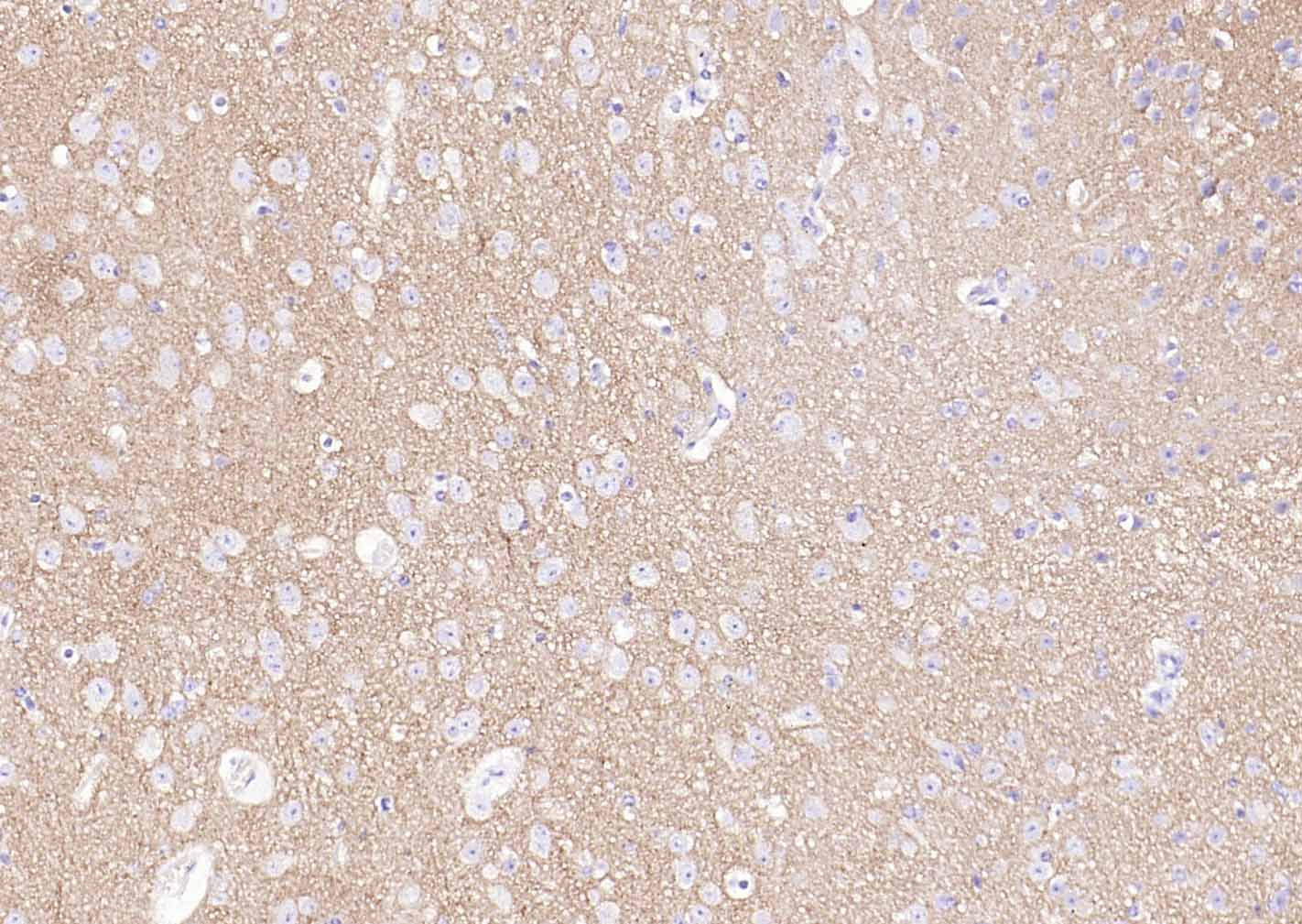 Synaptophysin Rabbit pAb (一抗) - WB,IHC-P,IHC-F,IF | Bioss