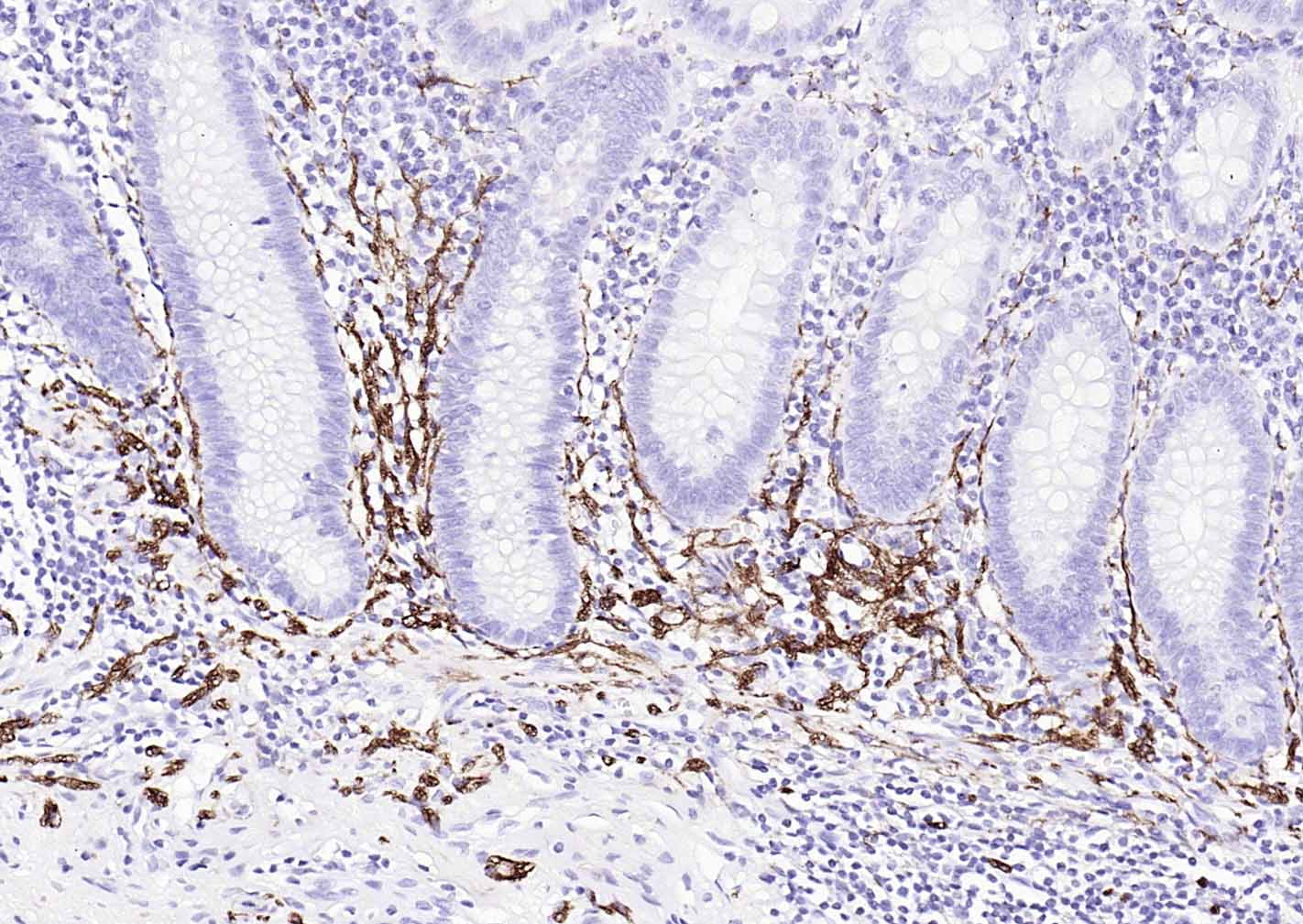 NCAM/CD56 Recombinant Mouse mAb (一抗) - IHC-P,IHC-F,IF | Bioss