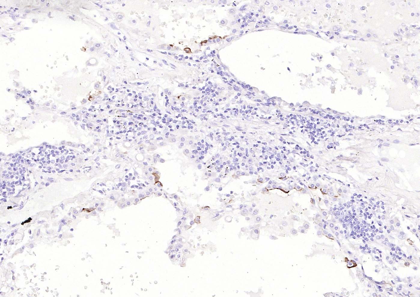 Mucin-1 Mouse mAb (一抗) | Bioss