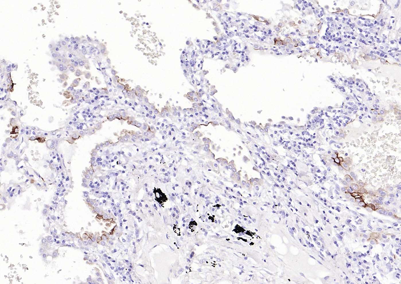 Mucin-1 Mouse mAb (一抗) - IHC-P,IHC-F,IF | Bioss