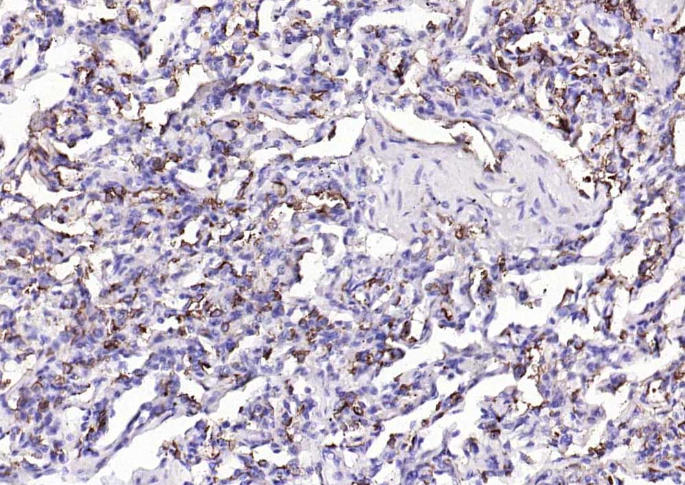 粘蛋白-1单克隆抗体-bsm-41731M