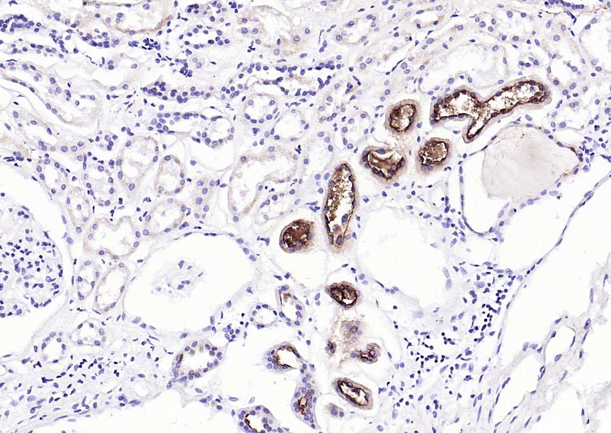 粘蛋白-1单克隆抗体-bsm-41732M