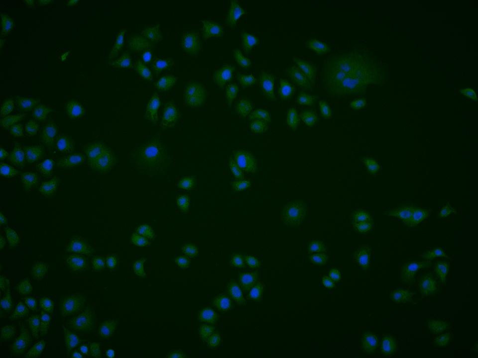 磷酸化凋亡相关蛋白4抗体-bs-12594R
