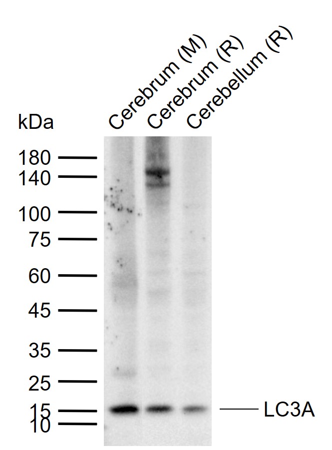 LC3A Mouse mAb (一抗) - WB,IHC-P,IHC-F,IF | Bioss