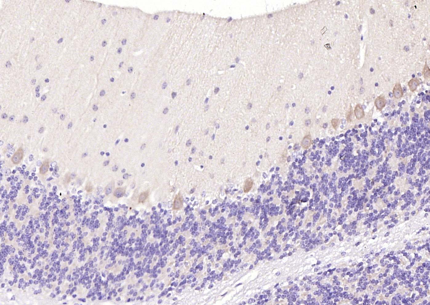 5-羟色胺受体7抗体-bs-12056R