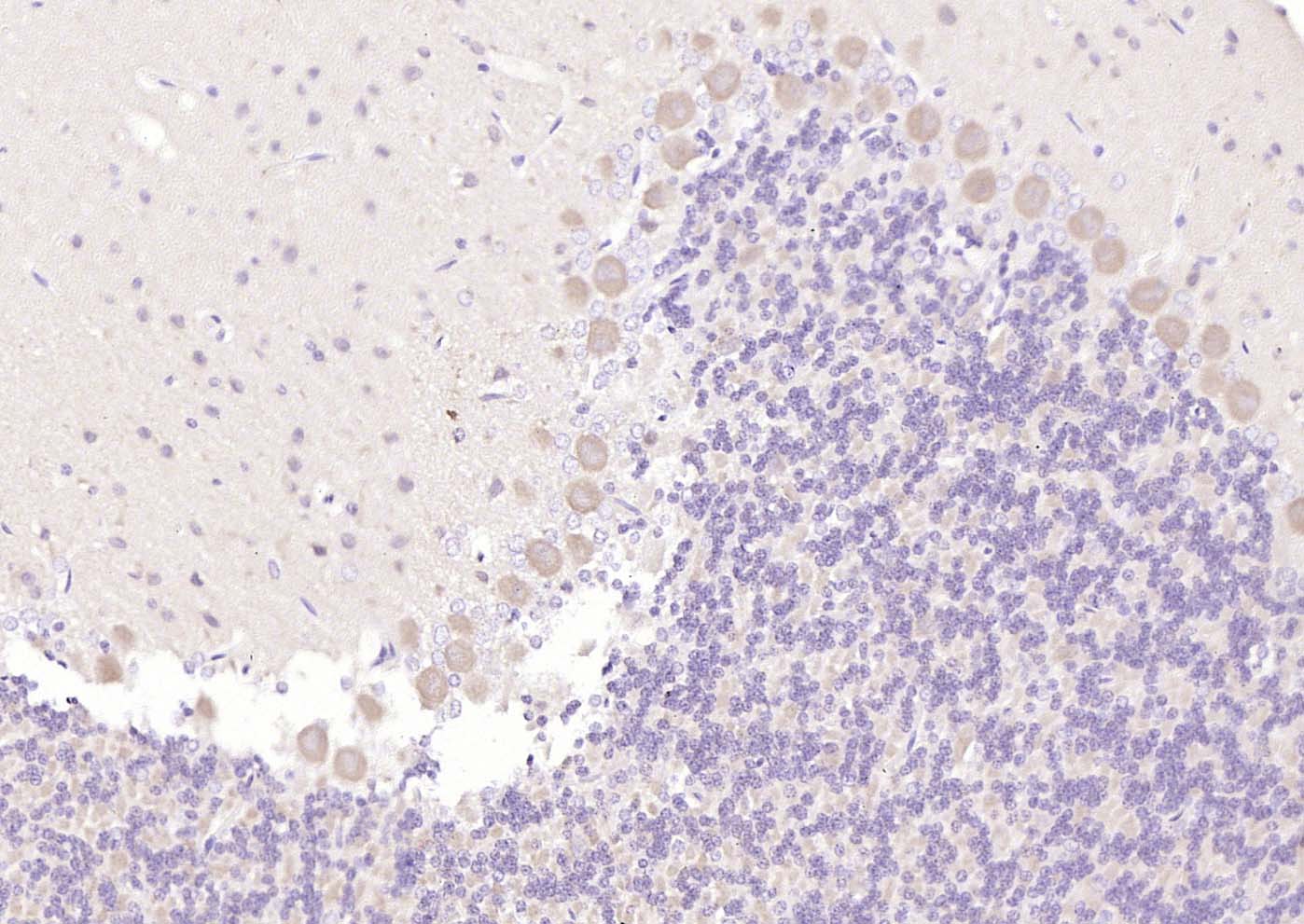 5-羟色胺受体7抗体-bs-12056R