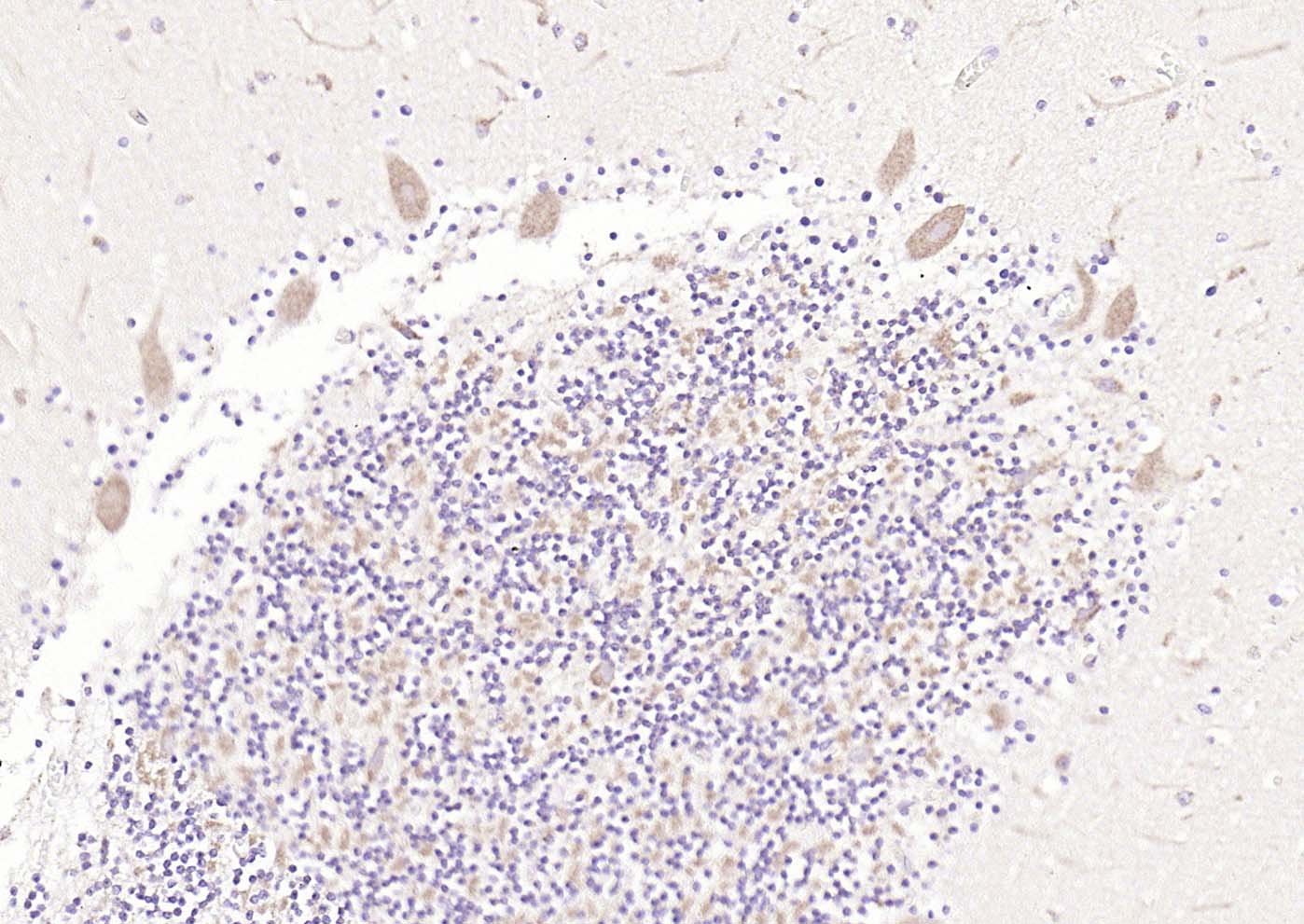 5-羟色胺受体7抗体-bs-12056R