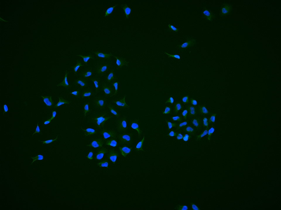 LATS1 Rabbit pAb (一抗) | Bioss