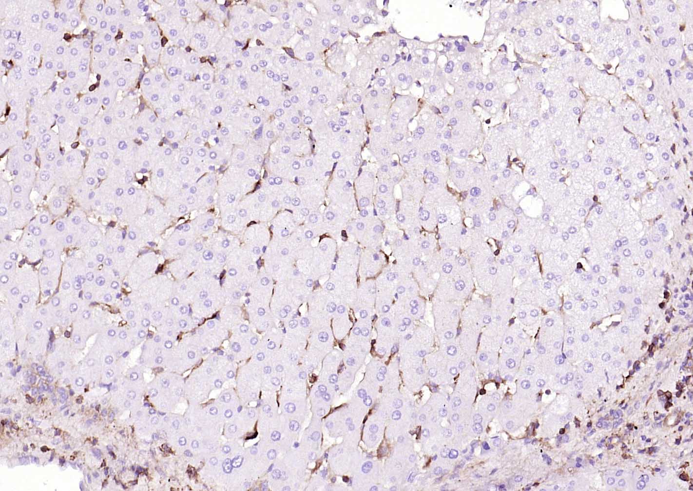 巨噬细胞甘露糖受体 (CD206) 重组兔单抗