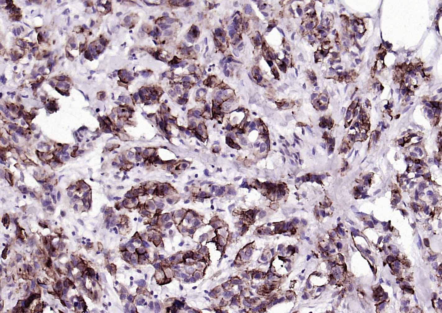 粘蛋白-1单克隆抗体-bsm-41731M