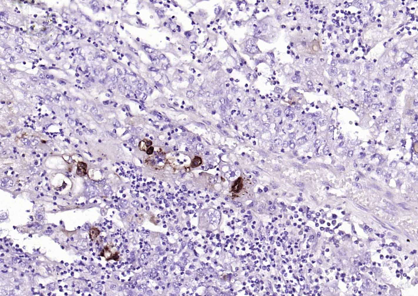 粘蛋白-1单克隆抗体-bsm-41731M