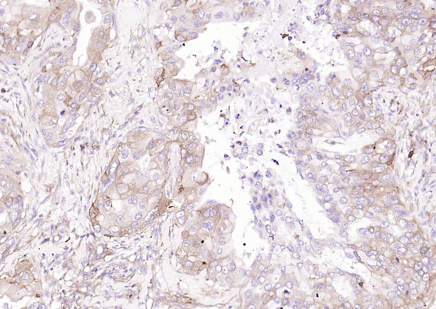 巨噬细胞甘露糖受体 (CD206) 重组兔单抗