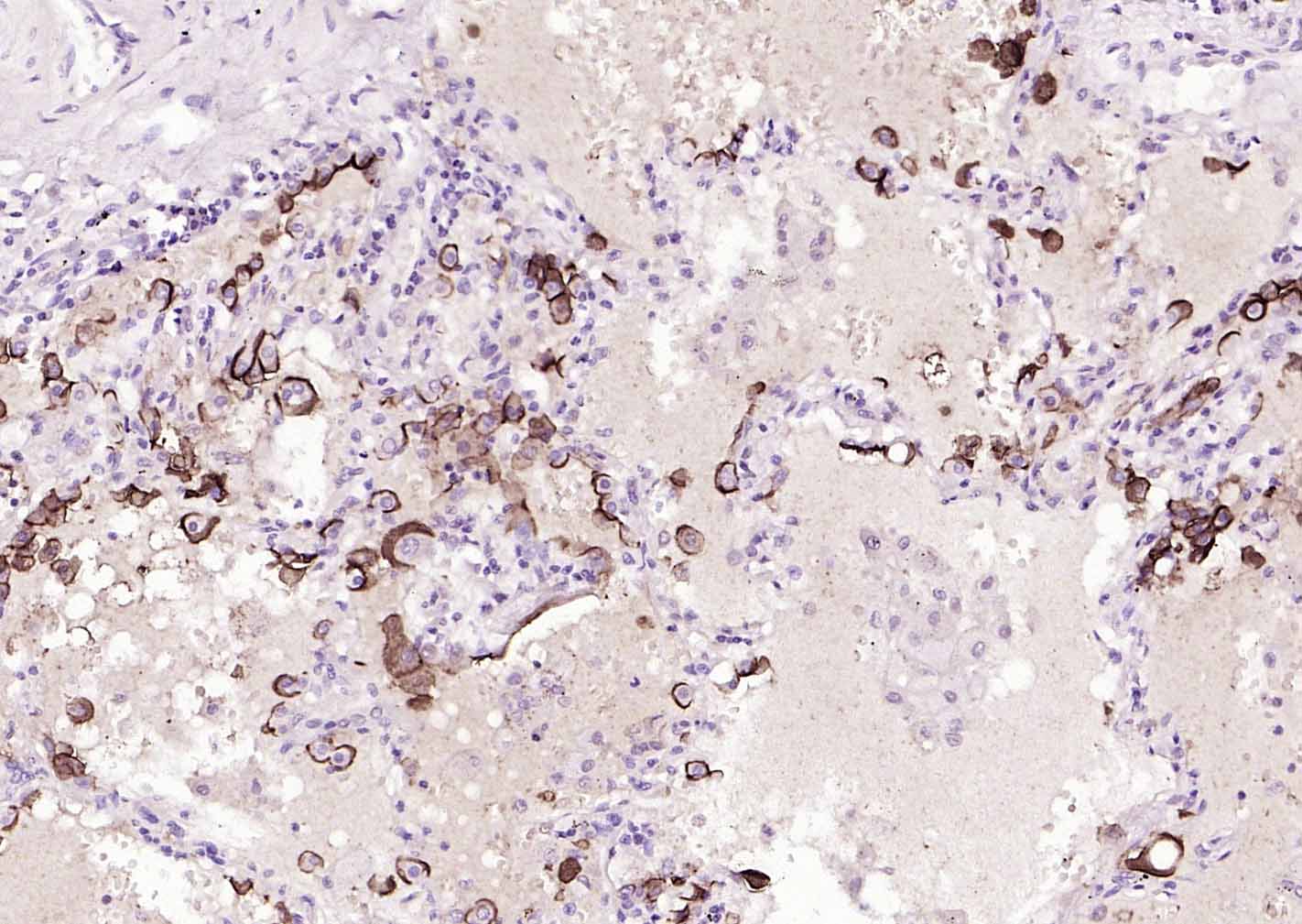 Mucin-1 Mouse mAb (一抗) - IHC-P,IHC-F,IF | Bioss