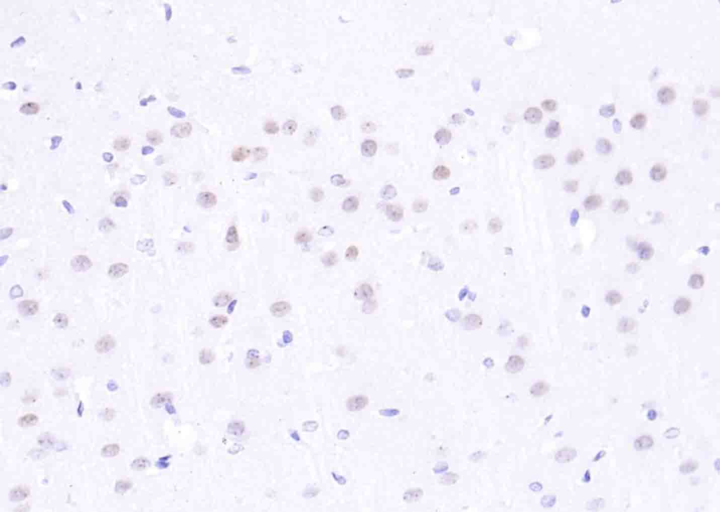 组蛋白H2AX抗体-bs-2560R