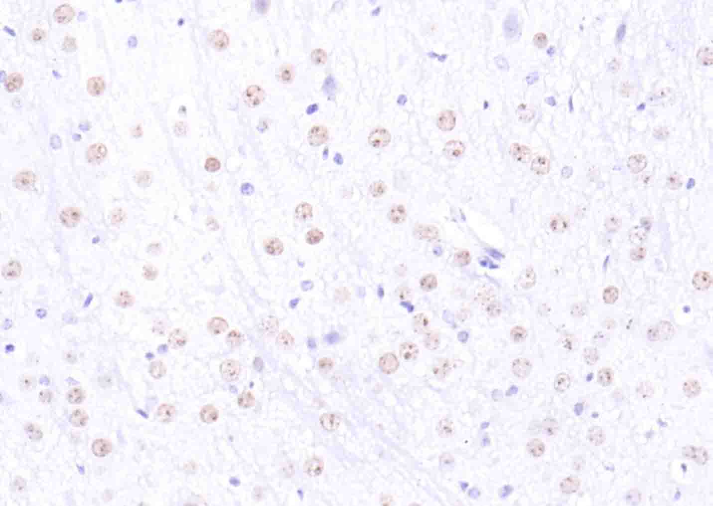 组蛋白H2AX抗体-bs-2560R