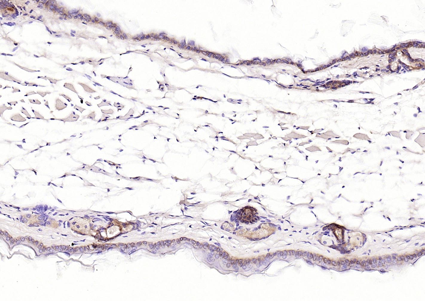 广谱细胞角蛋白PCK单克隆抗体
