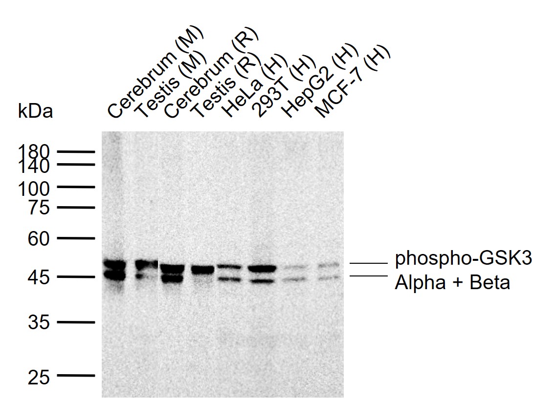磷酸化糖原合酶激酶3α/β重组兔单抗