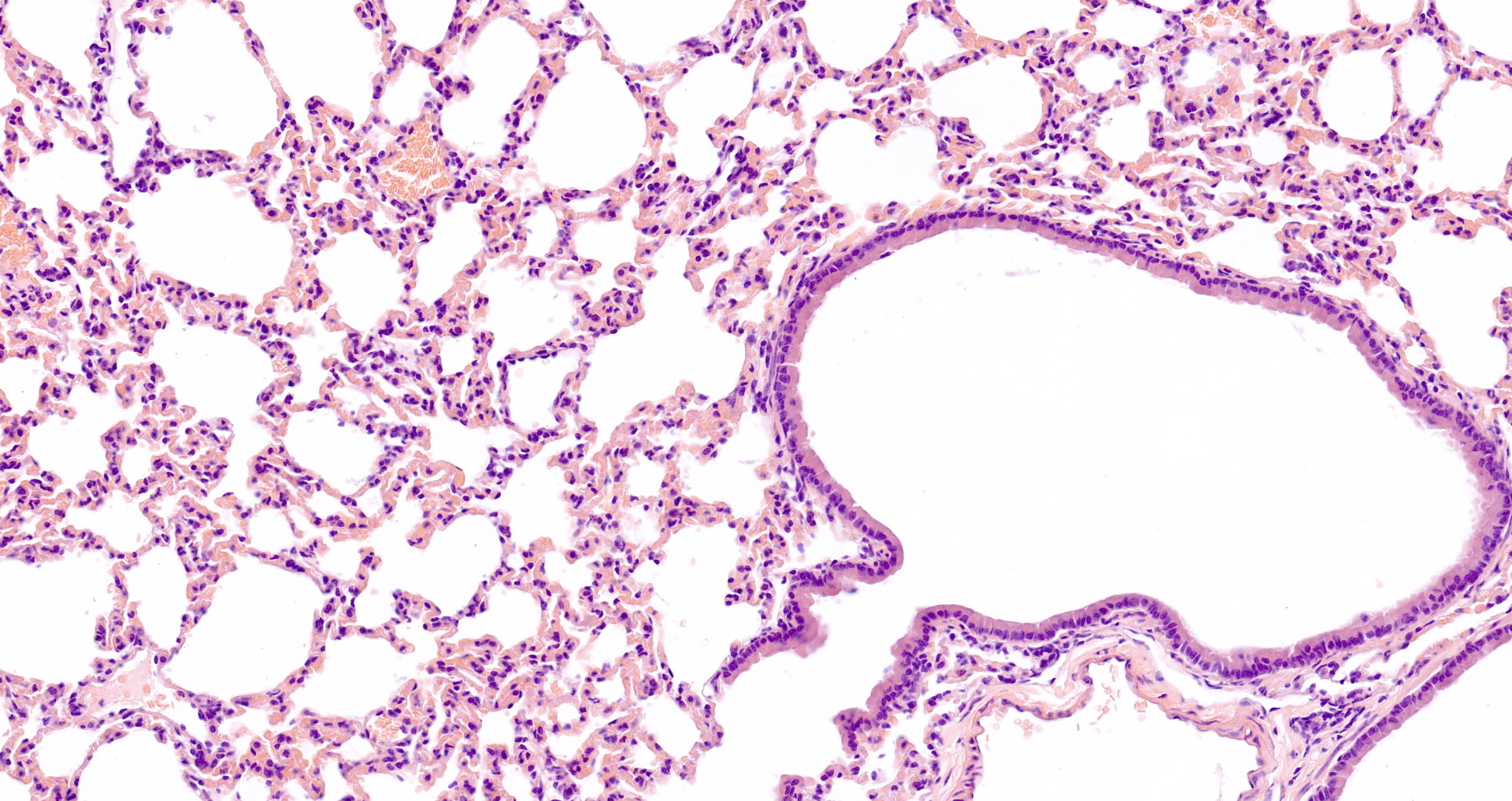 苏木素-伊红染色试剂盒