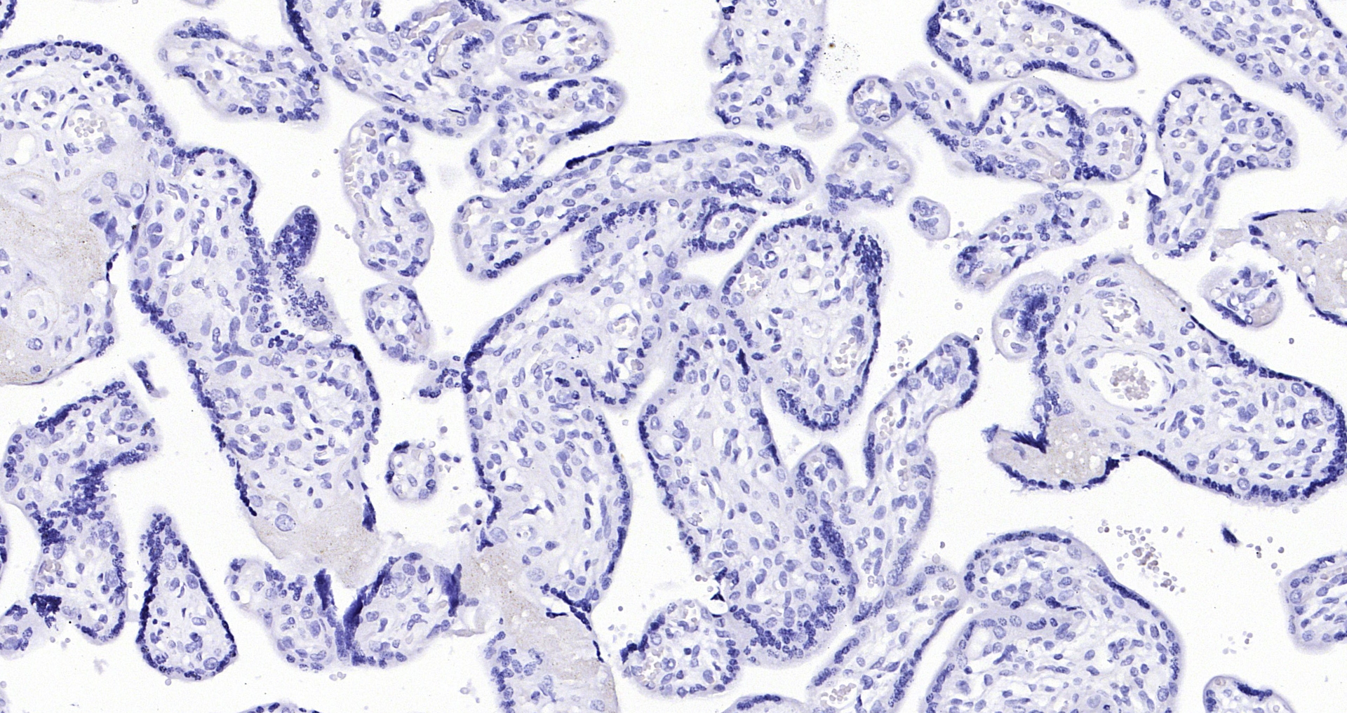 Modified Harris Hematoxylin solution (染色液) | Bioss