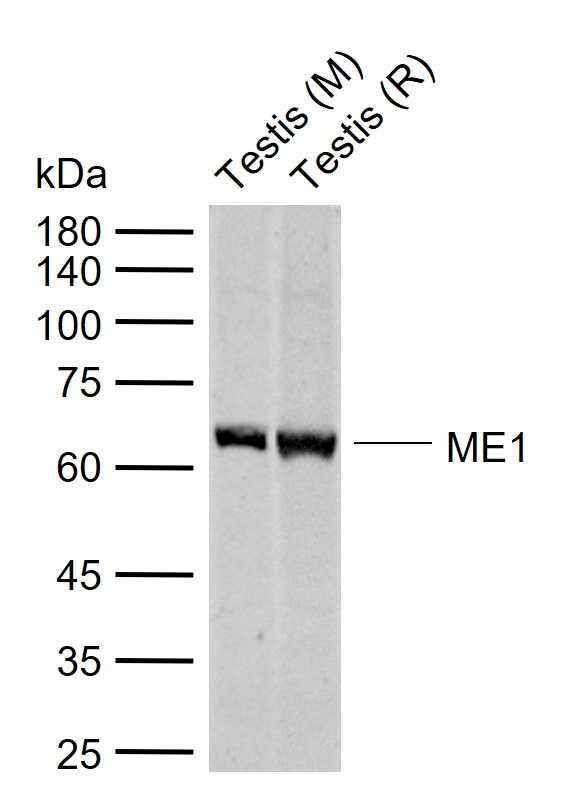 ME1 Rabbit pAb (一抗) | Bioss