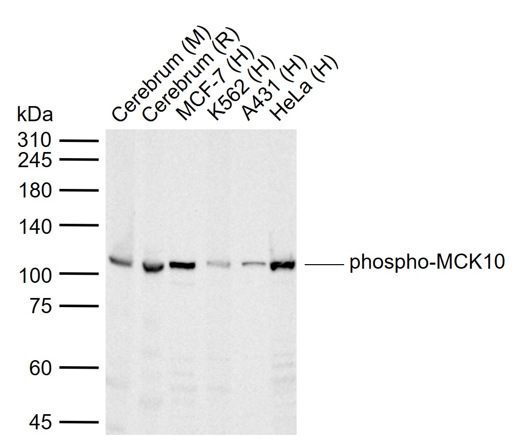 phospho-DDR1 (Tyr513) Rabbit pAb (一抗) | Bioss