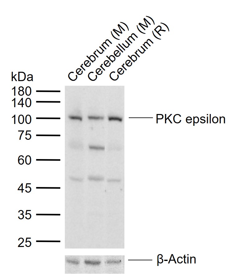 PKC epsilon Rabbit pAb (一抗) | Bioss