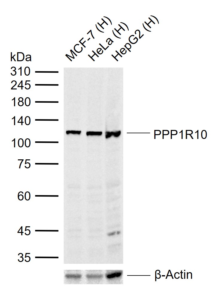 PPP1R10 Rabbit pAb (一抗) - WB,IHC-P,IHC-F,IF,ICC/IF | Bioss