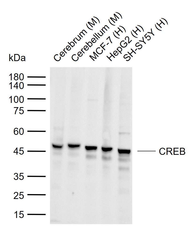 环腺苷酸应答元件结合蛋白重组兔单抗
