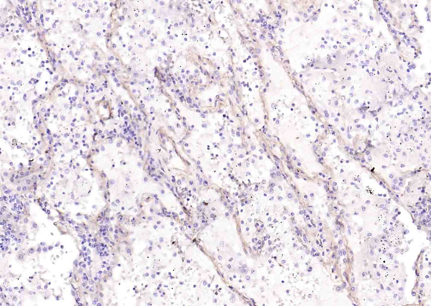 IV型胶原蛋白重组兔单抗