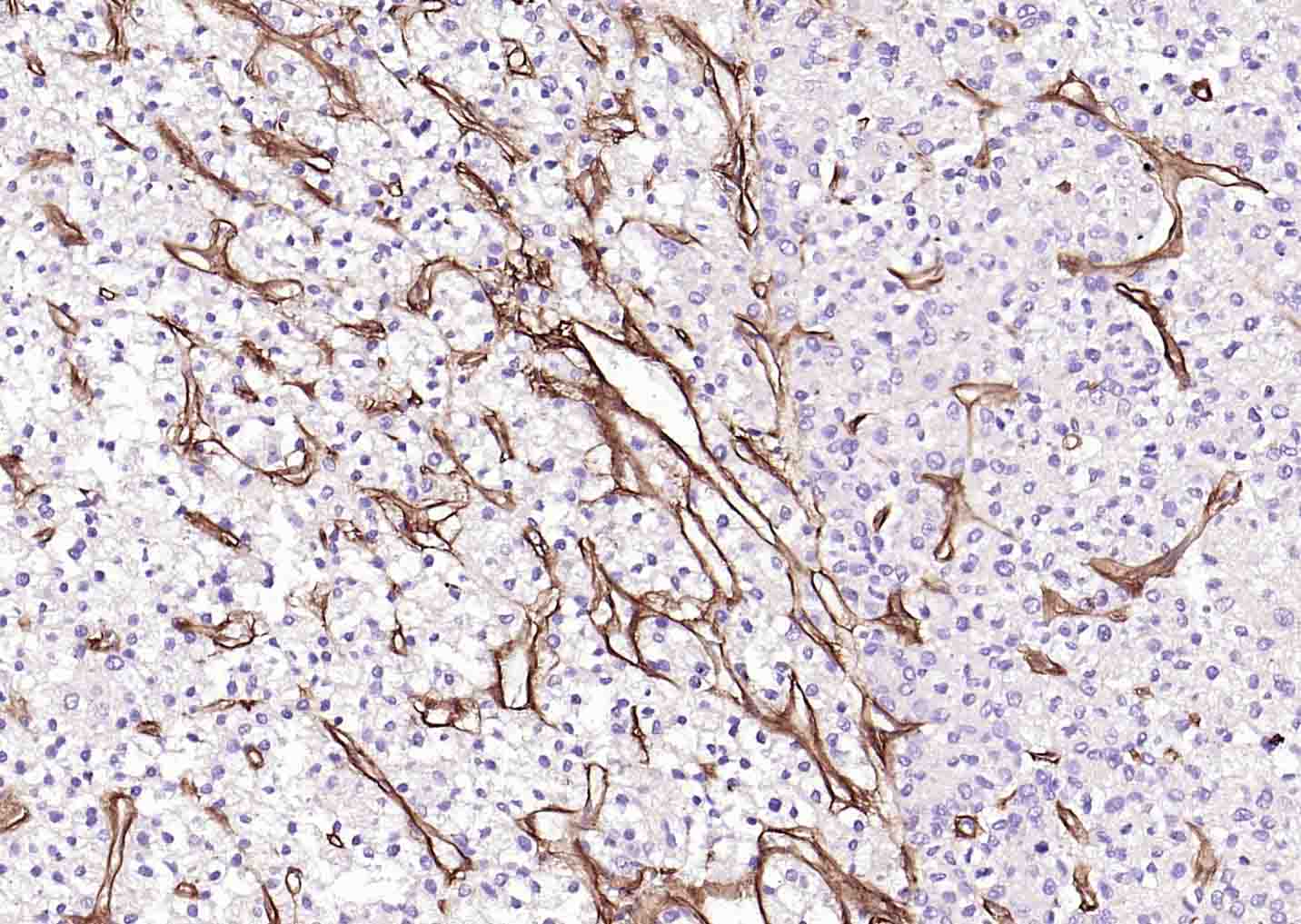 IV型胶原蛋白重组兔单抗