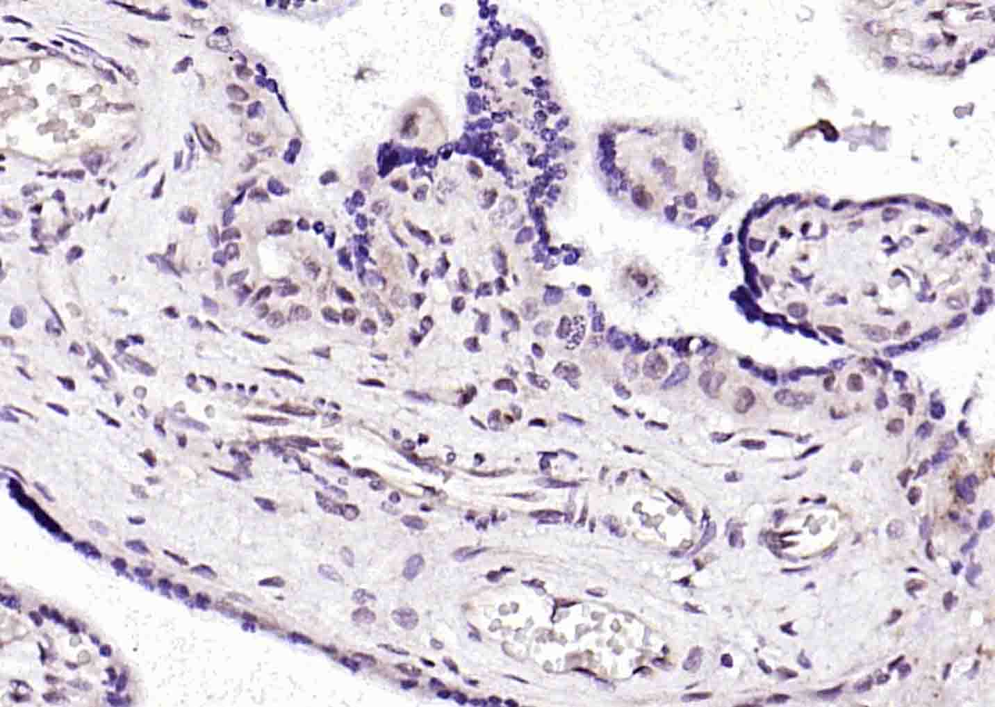 甲基化CpG结合蛋白抗体-bs-5915R