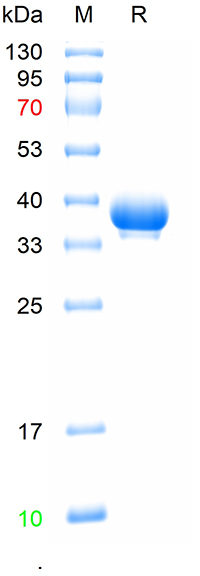 Agkistrodon halys Batroxobin (天然蛋白) | Bioss