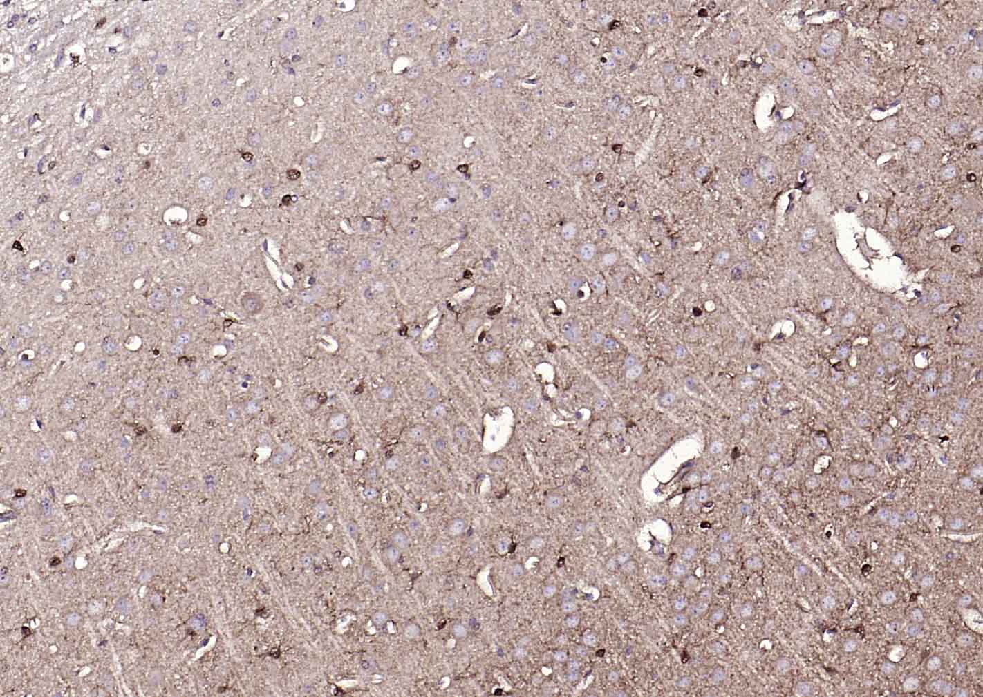 S100A1 Rabbit pAb (一抗) - IHC-P,IHC-F,IF | Bioss