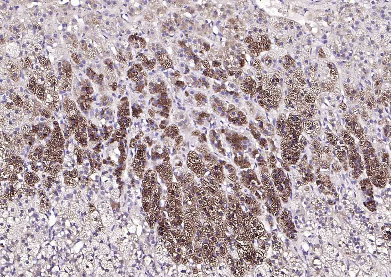 滋养层细胞抗原3β-HSD抗体-bs-16551R