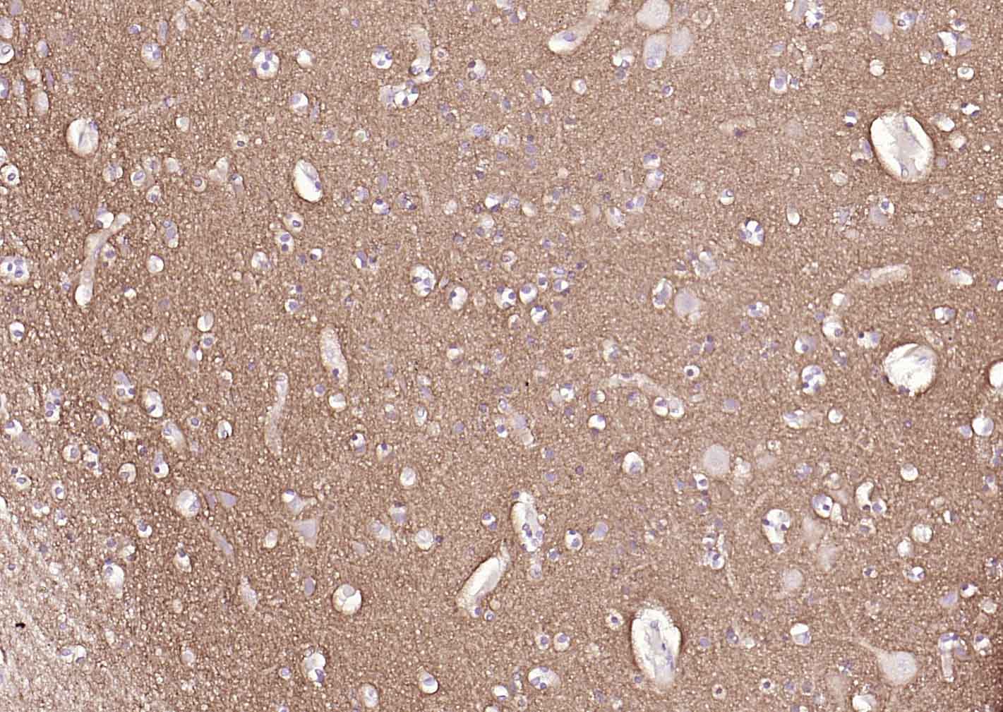 神经生长相关蛋白43单克隆抗体-bsm-33192M