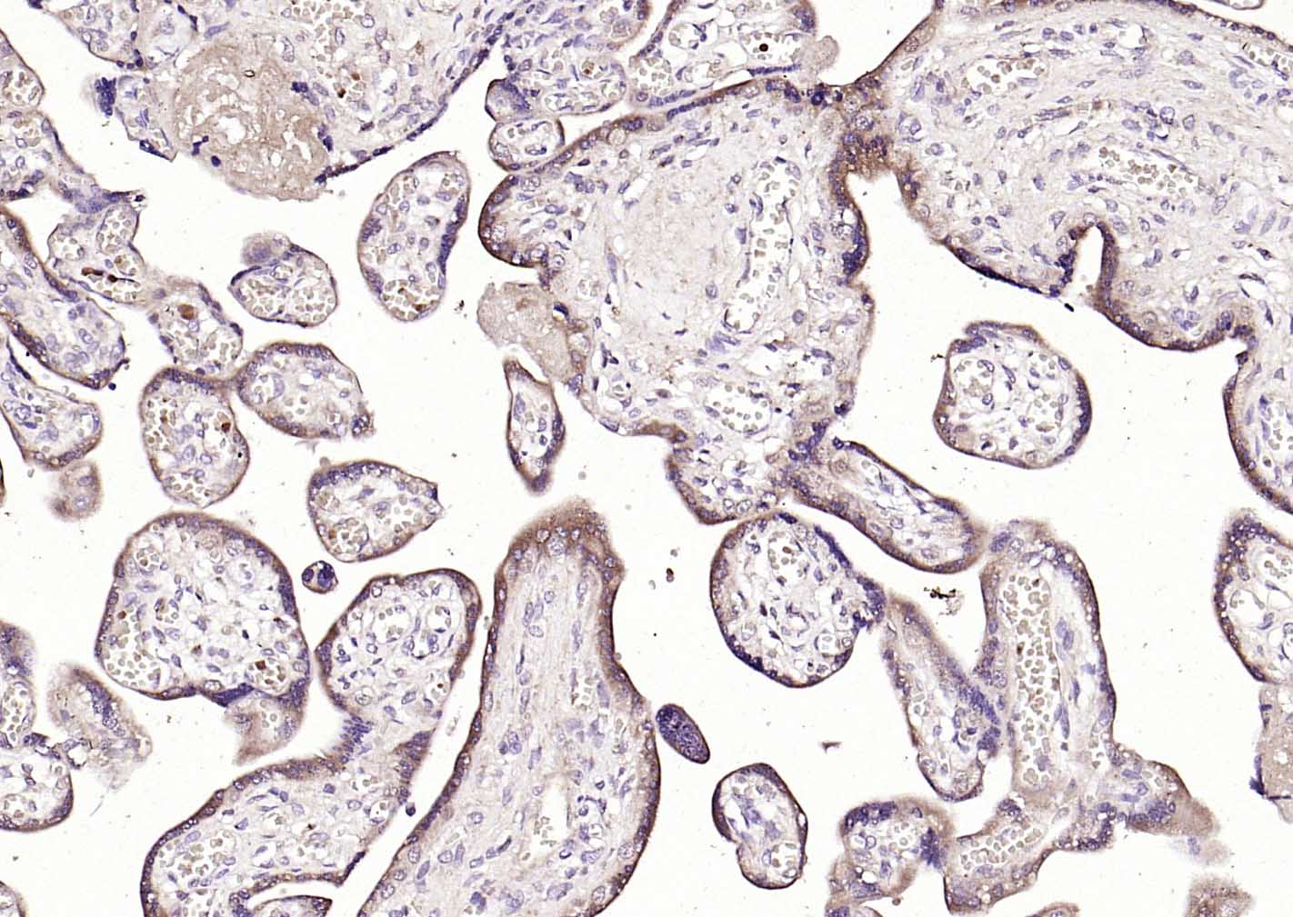 滋养层细胞抗原3β-HSD抗体-bs-16551R